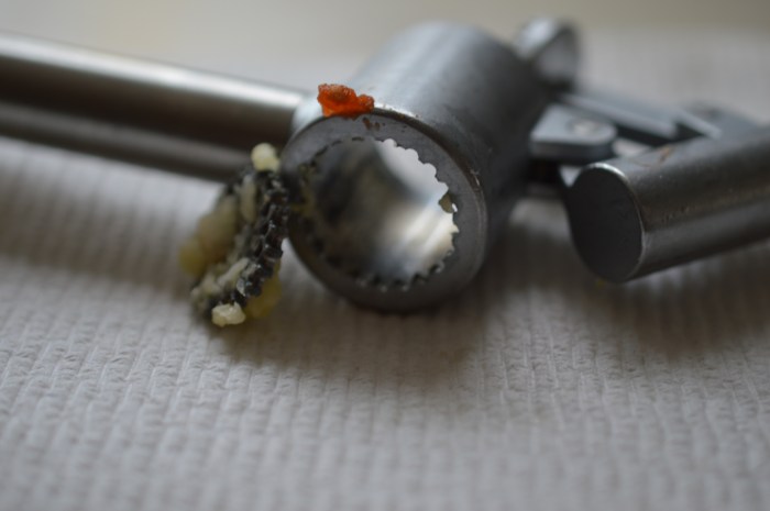 broken Garlic press